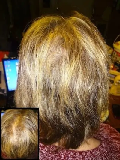 Bioten Biotin Hair Growth